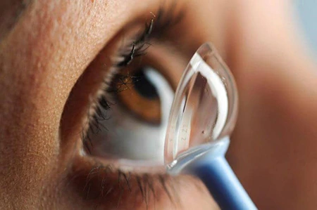 Contact Lens fitting by Kiran Challa Contact Lens fitting by Kiran Challa